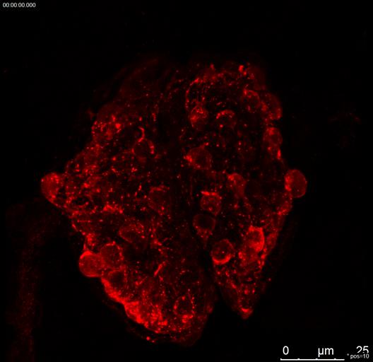 3D rendering of two pronephric glomeruli